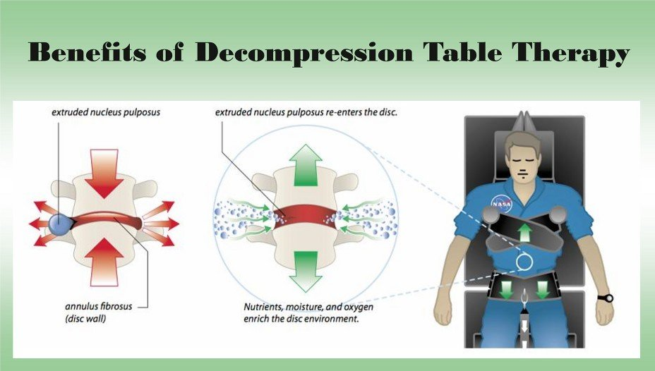 benefits-of-spinal-decompression