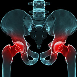 Osteoporosis.jpg